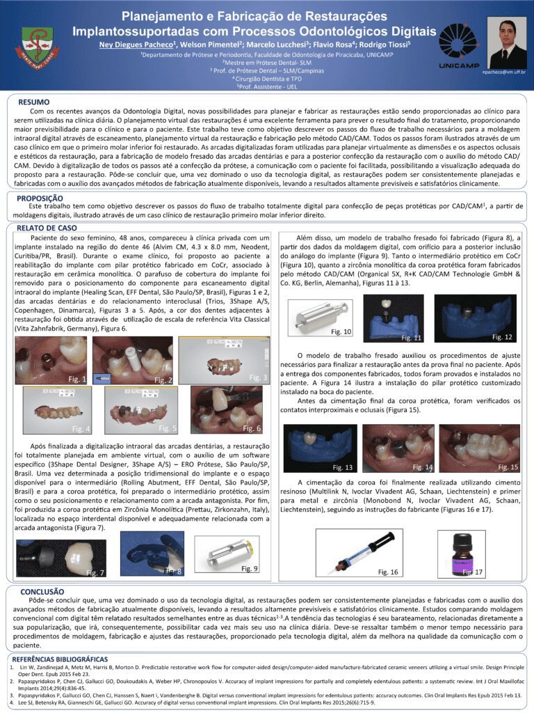 planejamento e fabricação de restaurações implantossuportadas com processos odontológicos digitais unicamp